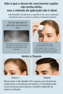 Derma Stamp 120 Agulhas | Microneedling Profundo para Crescimento Capilar e Rejuvenescimento da Pele