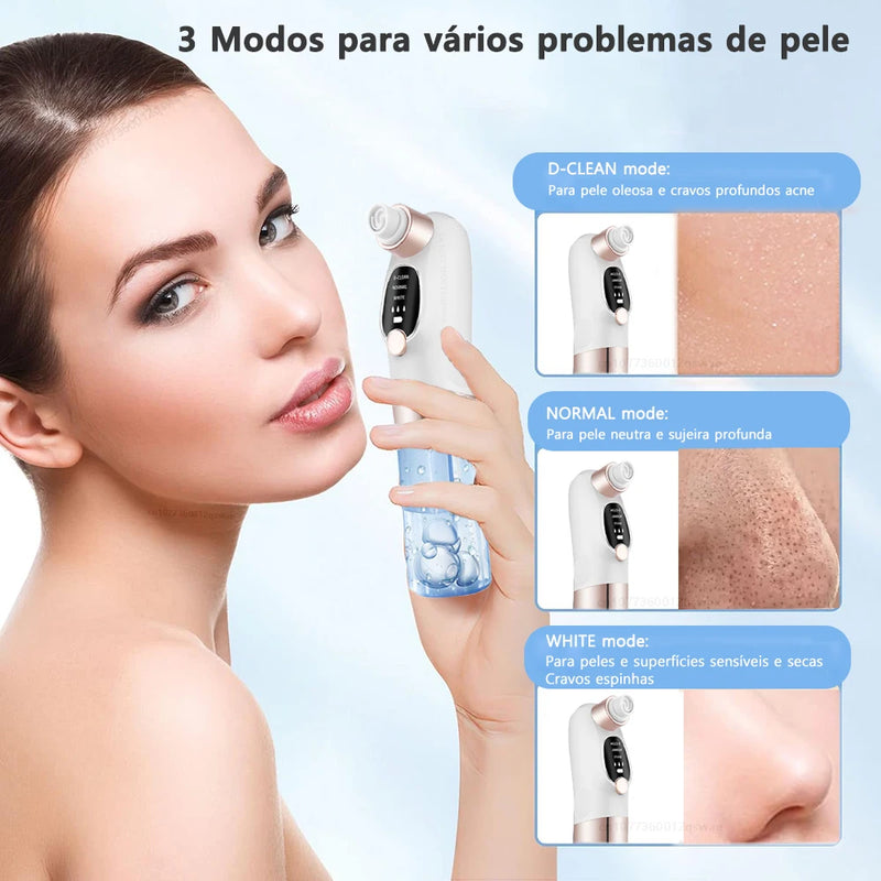 Removedor de Cravos à Vácuo Elétrico e Ciclo de Água