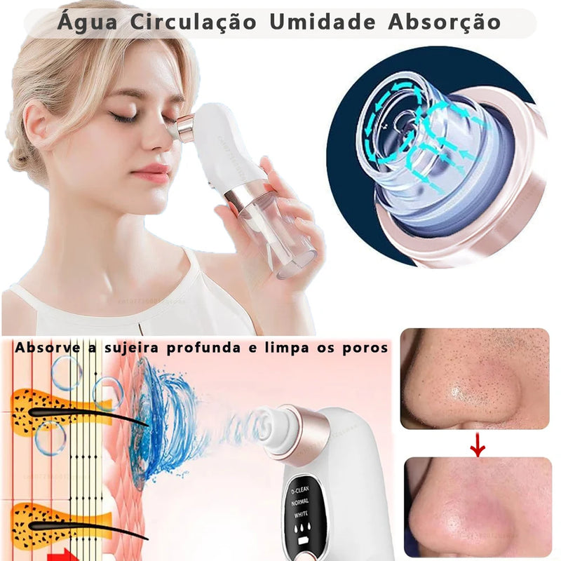 Removedor de Cravos à Vácuo Elétrico e Ciclo de Água